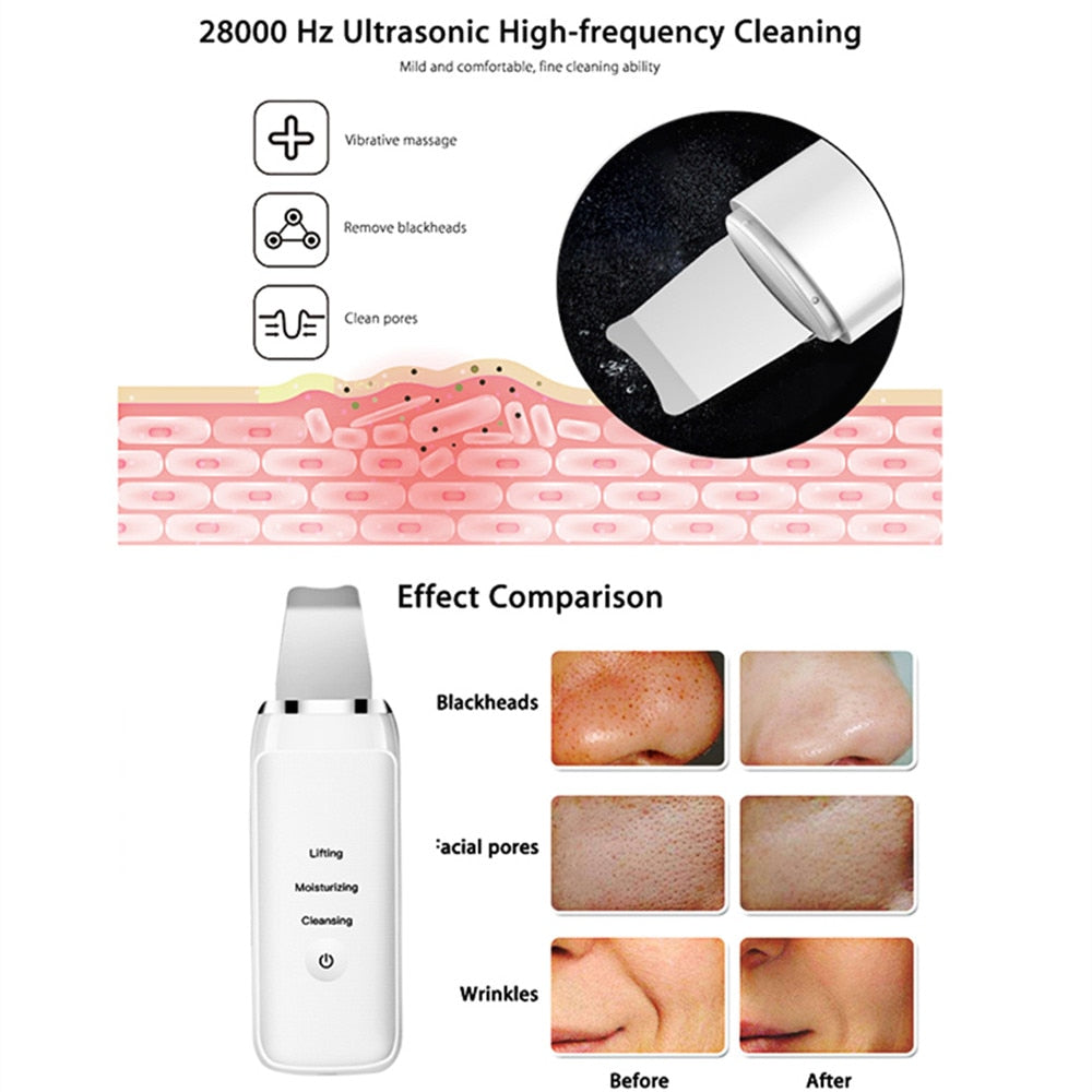 Ultrasonic Skin Scrubber: cleanse, moisturize, & massage